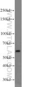 Myeloperoxidase antibody, 22225-1-AP, Proteintech Group, Western Blot image 