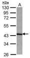 Lysine-specific demethylase NO66 antibody, PA5-31439, Invitrogen Antibodies, Western Blot image 