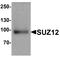 SUZ12 Polycomb Repressive Complex 2 Subunit antibody, A00583, Boster Biological Technology, Western Blot image 