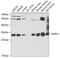 Inositol monophosphatase 1 antibody, GTX54348, GeneTex, Western Blot image 