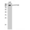 Catenin Delta 1 antibody, LS-C381510, Lifespan Biosciences, Western Blot image 