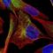 Desmin antibody, NBP2-59056, Novus Biologicals, Immunofluorescence image 
