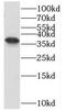 OTU Domain Containing 6B antibody, FNab06042, FineTest, Western Blot image 