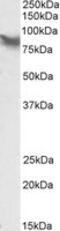 LIM Domain Containing Preferred Translocation Partner In Lipoma antibody, MBS421637, MyBioSource, Western Blot image 