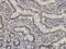 Myocyte Enhancer Factor 2A antibody, H00004205-M01, Novus Biologicals, Immunohistochemistry paraffin image 