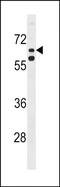 Kelch Like Family Member 38 antibody, PA5-48801, Invitrogen Antibodies, Western Blot image 