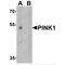 Serine/threonine-protein kinase PINK1, mitochondrial antibody, TA349062, Origene, Western Blot image 