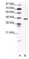 Gamma-Aminobutyric Acid Type A Receptor Pi Subunit antibody, PA1-24281, Invitrogen Antibodies, Western Blot image 