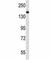 NPC Intracellular Cholesterol Transporter 1 antibody, F42992-0.4ML, NSJ Bioreagents, Immunofluorescence image 