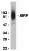 Signal Regulatory Protein Alpha antibody, 2428, QED Bioscience, Western Blot image 