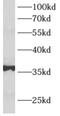 Aldolase, Fructose-Bisphosphate B antibody, FNab00302, FineTest, Western Blot image 