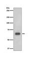 Ribosomal Protein S6 Kinase B1 antibody, M01475, Boster Biological Technology, Western Blot image 