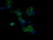 Mitogen-Activated Protein Kinase Kinase 3 antibody, M02916-3, Boster Biological Technology, Immunofluorescence image 