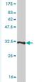 Thymosin Beta 4 X-Linked antibody, H00007114-M03-100ug, Novus Biologicals, Western Blot image 