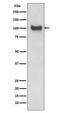 Vascular Cell Adhesion Molecule 1 antibody, M01199-1, Boster Biological Technology, Western Blot image 