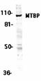 Stearoyl-CoA Desaturase antibody, orb19132, Biorbyt, Western Blot image 