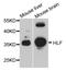 HLF Transcription Factor, PAR BZIP Family Member antibody, STJ24033, St John