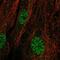 TRNA Methyltransferase 9B (Putative) antibody, PA5-55150, Invitrogen Antibodies, Immunofluorescence image 