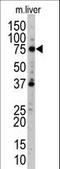 UV Radiation Resistance Associated antibody, LS-C160494, Lifespan Biosciences, Western Blot image 