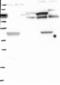 Aldehyde Dehydrogenase 1 Family Member L2 antibody, NBP1-81935, Novus Biologicals, Western Blot image 
