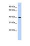 Metallophosphoesterase 1 antibody, NBP1-69305, Novus Biologicals, Western Blot image 