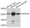 G Protein-Coupled Receptor Class C Group 5 Member A antibody, STJ110472, St John