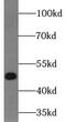 MAK16 Homolog antibody, FNab04957, FineTest, Western Blot image 