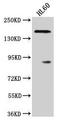 Rho Associated Coiled-Coil Containing Protein Kinase 1 antibody, CSB-PA614415HA01HU, Cusabio, Western Blot image 