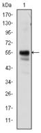 RUNX Family Transcription Factor 1 antibody, STJ98371, St John
