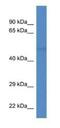 Tubulin Alpha 8 antibody, NBP1-74176, Novus Biologicals, Western Blot image 