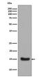 Midkine antibody, M01823, Boster Biological Technology, Western Blot image 