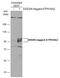 V-type proton ATPase 116 kDa subunit a isoform 2 antibody, GTX110248, GeneTex, Western Blot image 