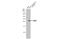 Matrix Metallopeptidase 7 antibody, GTX104658, GeneTex, Western Blot image 