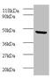Bone Morphogenetic Protein 7 antibody, A52444-100, Epigentek, Western Blot image 