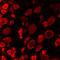 Acid Sensing Ion Channel Subunit 2 antibody, NB100-2531, Novus Biologicals, Immunohistochemistry frozen image 