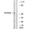 Potassium Voltage-Gated Channel Modifier Subfamily S Member 2 antibody, PA5-50091, Invitrogen Antibodies, Western Blot image 