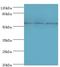 Transducin Beta Like 1 X-Linked Receptor 1 antibody, LS-C379960, Lifespan Biosciences, Western Blot image 