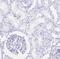 POU Class 2 Homeobox 3 antibody, NBP1-83966, Novus Biologicals, Immunohistochemistry paraffin image 