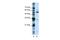 KH RNA Binding Domain Containing, Signal Transduction Associated 3 antibody, A06622, Boster Biological Technology, Western Blot image 
