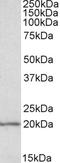 Eukaryotic Translation Initiation Factor 5A antibody, EB09590, Everest Biotech, Western Blot image 