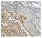 Gasdermin D antibody, M02842, Boster Biological Technology, Immunohistochemistry paraffin image 