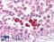 Checkpoint Kinase 2 antibody, LS-B1348, Lifespan Biosciences, Immunohistochemistry paraffin image 