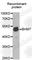 Betaine--Homocysteine S-Methyltransferase antibody, A1216, ABclonal Technology, Western Blot image 