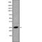 Chemokine-like factor superfamily member 5 antibody, abx149421, Abbexa, Western Blot image 