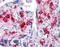 NK3 Homeobox 1 antibody, LS-B4156, Lifespan Biosciences, Immunohistochemistry paraffin image 