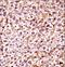 Casein Kinase 1 Epsilon antibody, LS-C164354, Lifespan Biosciences, Immunohistochemistry paraffin image 