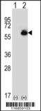 Delta-1-pyrroline-5-carboxylate dehydrogenase, mitochondrial antibody, 63-260, ProSci, Western Blot image 