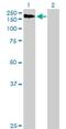 Amylo-Alpha-1, 6-Glucosidase, 4-Alpha-Glucanotransferase antibody, H00000178-B01P, Novus Biologicals, Western Blot image 