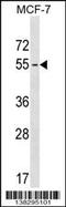 MAGE Family Member B18 antibody, 59-769, ProSci, Western Blot image 