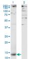 C-Type Lectin Domain Family 4 Member M antibody, MA5-21012, Invitrogen Antibodies, Western Blot image 